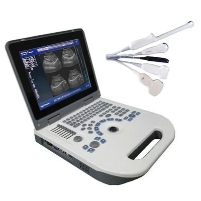 गुणवत्ता  TGC Control Notebook Ultrasound Scanner For Pregnancy Home Use कारखाना