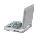 15 इंच एलईडी रंग पोर्टेबल अल्ट्रासाउंड मशीन 60 डिग्री स्कैन कोण और ≥250 मिमी गहराई डिस्प्ले के साथ