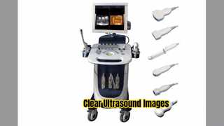 डॉपलर अल्ट्रासाउंड स्कैनर पीडब्लू सीएफएम पीडीआई मोड