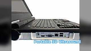 पोर्टेबल अल्ट्रासाउंड E20 क्लिनिकल अस्पताल