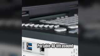 पोर्टेबल 4डी डॉपलर अल्ट्रासाउंड मशीन आईसीयू तैयार