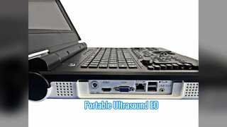 पोर्टेबल कलर डॉपलर अल्ट्रासाउंड E0 यूरोलॉजी स्कैन